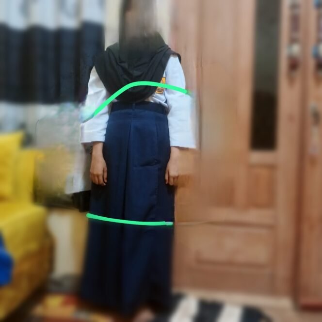 
					Seorang siswa mencoba baju seragam sekolah gratis yang dibagikan. Sudah kekecilan, Selasa, (31/03/2026)